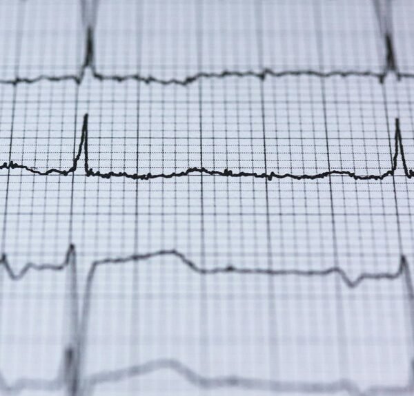 Global Pulse 600135109 Revenue Influence